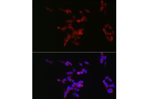 Immunofluorescence analysis of SH-SY5Y cells using Neurofilament M Rabbit pAb (ABIN7268865) at dilution of 1:50 (40x lens).