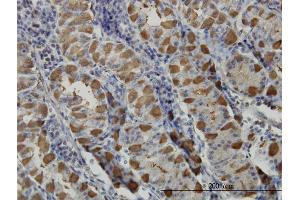 Immunoperoxidase of monoclonal antibody to GGA1 on formalin-fixed paraffin-embedded human stomach.