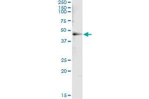 Immunoprecipitation of HDAC8 transfected lysate using anti-HDAC8 monoclonal antibody and Protein A Magnetic Bead , and immunoblotted with HDAC8 MaxPab rabbit polyclonal antibody.