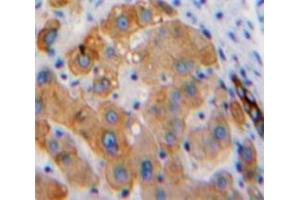 IHC-P analysis of Liver tissue, with DAB staining. (Hexosaminidase A anticorps  (AA 319-528))