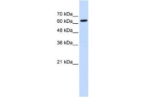 WB Suggested Anti-LGTN Antibody Titration:  0. (EIF2D anticorps  (Middle Region))