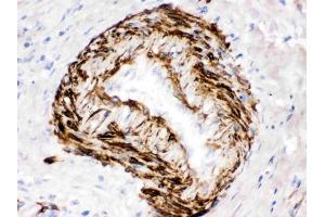 IHC analysis of SMYD3 using anti-SMYD3 antibody (ABIN3044548). (SMYD3 anticorps  (C-Term))