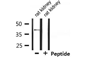 Western blot analysis of extracts from rat kidney, using CCRL1 Antibody. (CCRL1 anticorps  (C-Term))