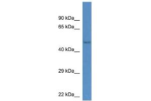 WB Suggested Anti-Gm13178 Antibody   Titration: 1. (Gm13178 anticorps  (C-Term))