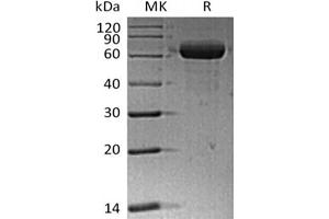 Western Blotting (WB) image for Sialic Acid Binding Ig-Like Lectin 15 (SIGLEC15) (Active) protein (Fc Tag) (ABIN7319768)