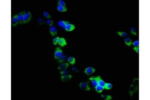 Immunofluorescence staining of PC3 cells with ABIN7167972 at 1:133, counter-stained with DAPI.