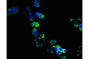 Immunofluorescence staining of PC3 cells with ABIN7167972 at 1:133, counter-stained with DAPI. (ARHGEF18 anticorps  (AA 159-551))
