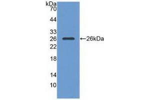 Western blot analysis of recombinant Human RASA1. (RASA1 anticorps  (AA 403-596))