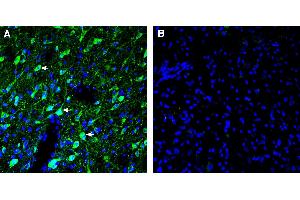Expression of 5HT6 in in rat dorsal raphe nucleus (DRN). (Serotonin Receptor 6 anticorps  (Extracellular))