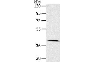 Western Blotting (WB) image for anti-Cyclin-Dependent Kinase 10 (CDK10) antibody (ABIN2421367) (CDK10 anticorps)