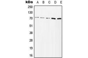 Western blot analysis of ZAP70 (pY315) expression in Jurkat H2O2-treated (A), HeLa H2O2-treated (B), Ramos lambda phosphatase-treated (C), mouse kidney (D), rat kidney (E) whole cell lysates.