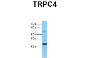 Host:  Rabbit  Target Name:  TRPC4  Sample Tissue:  Human 293T  Antibody Dilution:  1. (TRPC4 anticorps  (Middle Region))