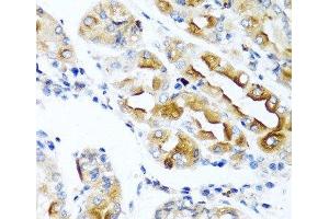 Immunohistochemistry of paraffin-embedded Human stomach using CCL21 Polyclonal Antibody at dilution of 1:100 (40x lens). (CCL21 anticorps)