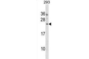 Western Blotting (WB) image for anti-Motile Sperm Domain Containing 3 (MOSPD3) antibody (ABIN2999651)
