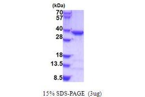 SDS-PAGE (SDS) image for Coatomer Protein Complex, Subunit epsilon (COPE) (AA 1-308) protein (His tag) (ABIN6387505)