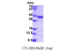 SDS-PAGE (SDS) image for Coatomer Protein Complex, Subunit epsilon (COPE) (AA 1-308) protein (His tag) (ABIN5779054) (COPE Protein (AA 1-308) (His tag))