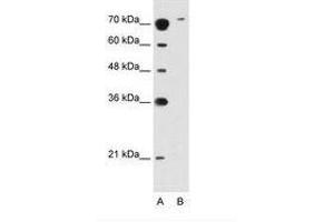 Image no. 2 for anti-Solute Carrier Family 7 (Cationic Amino Acid Transporter, Y+ System), Member 14 (SLC7A14) (AA 131-180) antibody (ABIN396880) (SLC7A14 anticorps  (AA 131-180))