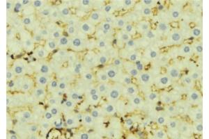 ABIN6276924 at 1/100 staining Mouse liver tissue by IHC-P. (CES1 anticorps  (C-Term))