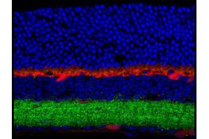 Immunohistochemistry of Anti-GABA(A) Receptor beta 3 (Rabbit) Antibody Immunohistochemistry of Anti-GABA(A) Receptor beta 3 (Rabbit) Antibody.