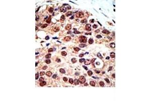 Image no. 3 for anti-Protein Arginine Methyltransferase 3 (PRMT3) (C-Term) antibody (ABIN356525) (PRMT3 anticorps  (C-Term))