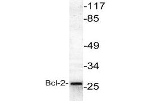 Image no. 1 for anti-B-Cell CLL/lymphoma 2 (BCL2) antibody (ABIN265326) (Bcl-2 anticorps)