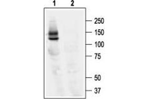 Western blot analysis of KV11.