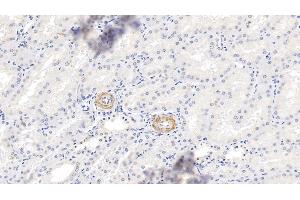 Detection of MYH11 in Human Kidney Tissue using Polyclonal Antibody to Myosin Heavy Chain 11, Smooth Muscle (MYH11)