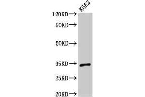 Western Blot Positive WB detected in: K562 whole cell lysate All lanes: TMEM177 antibody at 3 μg/mL Secondary Goat polyclonal to rabbit IgG at 1/50000 dilution Predicted band size: 34 kDa Observed band size: 34 kDa (TMEM177 anticorps  (AA 219-311))