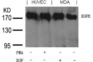 Image no. 1 for anti-Epidermal Growth Factor Receptor (EGFR) (Tyr1197) antibody (ABIN401656) (EGFR anticorps  (Tyr1197))