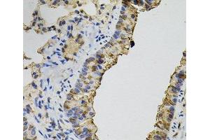 Immunohistochemistry of paraffin-embedded Mouse lung using DNM2 Polyclonal Antibody (DNM2 anticorps)