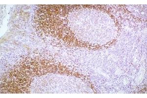 Image no. 1 for anti-Cadherin 1, Type 1, E-Cadherin (Epithelial) (CDH1) antibody (ABIN335398) (E-cadherin anticorps)