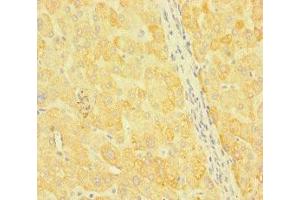 Immunohistochemistry of paraffin-embedded human liver tissue using ABIN7170352 at dilution of 1:100 (SNX14 anticorps  (AA 601-893))