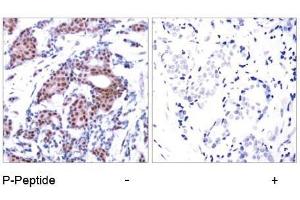 Image no. 2 for anti-ELK1, Member of ETS Oncogene Family (ELK1) (pSer383) antibody (ABIN196614) (ELK1 anticorps  (pSer383))