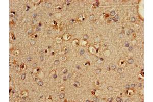 Immunohistochemistry of paraffin-embedded human brain tissue using ABIN7163337 at dilution of 1:100 (PLD3 anticorps  (AA 70-176))