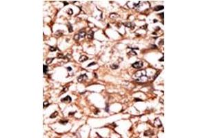 Image no. 1 for anti-Tumor Necrosis Factor Receptor Superfamily, Member 1A (TNFRSF1A) (pSer274) antibody (ABIN358242)