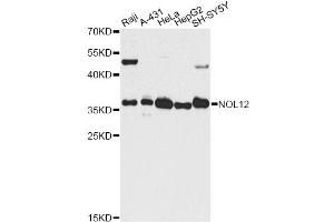 Western blot analysis of extracts of various cell lines, using NOL12 antibody. (NOL12 anticorps)