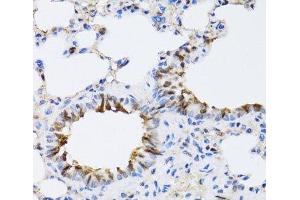 Immunohistochemistry of paraffin-embedded Rat lung using NAA10 Polyclonal Antibody at dilution of 1:100 (40x lens). (NAA10 anticorps)