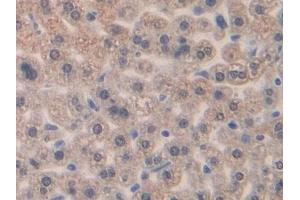IHC-P analysis of Mouse Liver Tissue, with DAB staining. (CCL4 anticorps  (AA 24-92))
