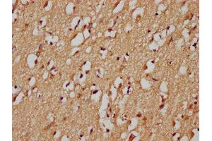 IHC image of ABIN7148390 diluted at 1:200 and staining in paraffin-embedded human brain tissue performed on a Leica BondTM system. (RHBDF1 anticorps  (AA 132-221))