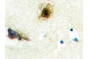 Image no. 1 for anti-Phosphofructokinase, Liver (PFKL) antibody (ABIN272176) (PFKL anticorps)