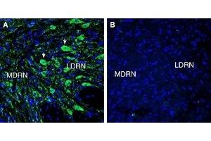 Expression of 5HT7 Receptor in rat dorsal raphe nucleus (DRN)Immunohistochemical staining of perfusion-fixed frozen rat brain sections with Anti-5HT7 Receptor/HTR7 (extracellular) Antibody (ABIN7042876, ABIN7045292 and ABIN7045293), (1:300), followed by goat anti-rabbit-AlexaFluor-488.