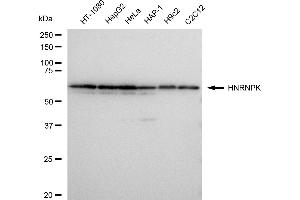 Western blotting analysis using HNRNPK antibody (ABIN7798900). (Recombinant HNRNPK anticorps)