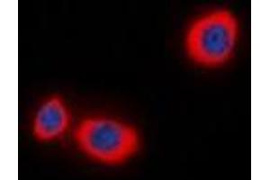 Immunofluorescent analysis of STMN1 (pS38) staining in MCF7 cells. (Stathmin 1 anticorps  (N-Term, pSer38))