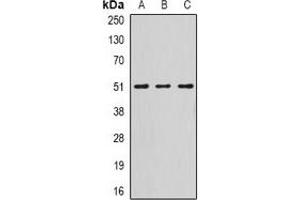 Western blot analysis of Serpin A10 expression in HepG2 (A), mouse liver (B), rat liver (C) whole cell lysates. (SERPINA10 anticorps)