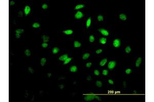 Immunofluorescence of monoclonal antibody to FOXF2 on HeLa cell. (FOXF2 anticorps  (AA 346-443))
