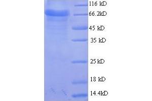 SDS-PAGE (SDS) image for Aspartyl Aminopeptidase (DNPEP) (AA 1-475), (full length) protein (His-SUMO Tag) (ABIN5709411)