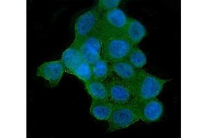 IF analysis of AKT2 using anti-AKT2 antibody (ABIN6719267).
