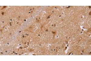 Immunohistochemistry of paraffin-embedded Human brain tissue using FBP2 Polyclonal Antibody at dilution 1:40 (FBP2 anticorps)