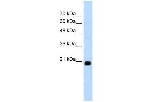 FBXO25 antibody used at 1. (FBXO25 anticorps  (C-Term))