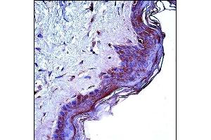 CD1A Antibody (Center) (ABIN657461 and ABIN2846488) immunohistochemistry analysis in formalin fixed and paraffin embedded human skin tissue followed by peroxidase conjugation of the secondary antibody and DAB staining.